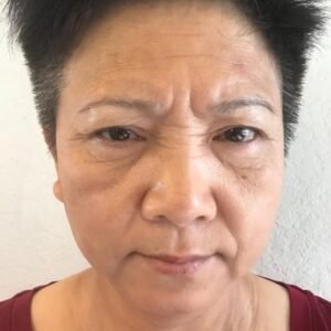 Anti Aging